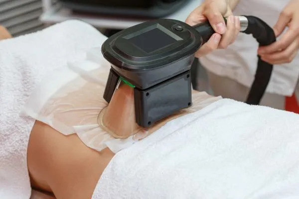 Image of person having fat freezing treatment to help weight gain Old Trafford