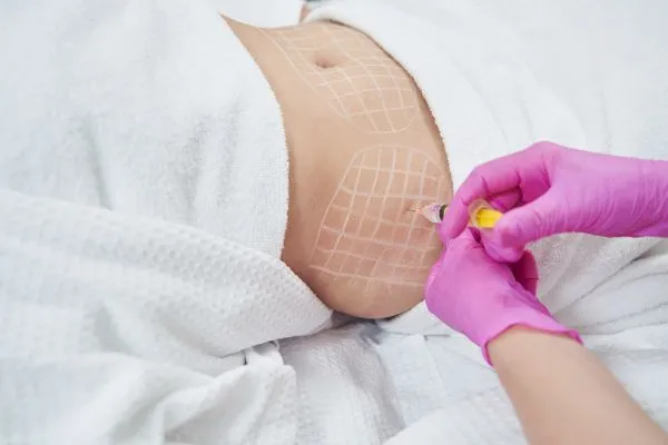 image of fat dissolving injections on love handles to help combat weight gain Old Trafford