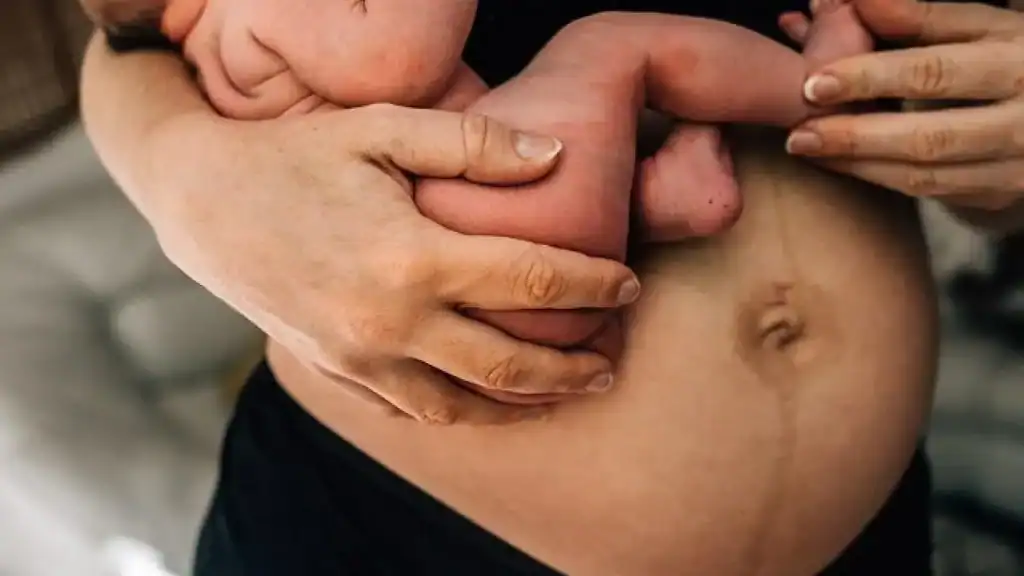 Why Is My Stomach Still Big After Pregnancy Old Trafford?